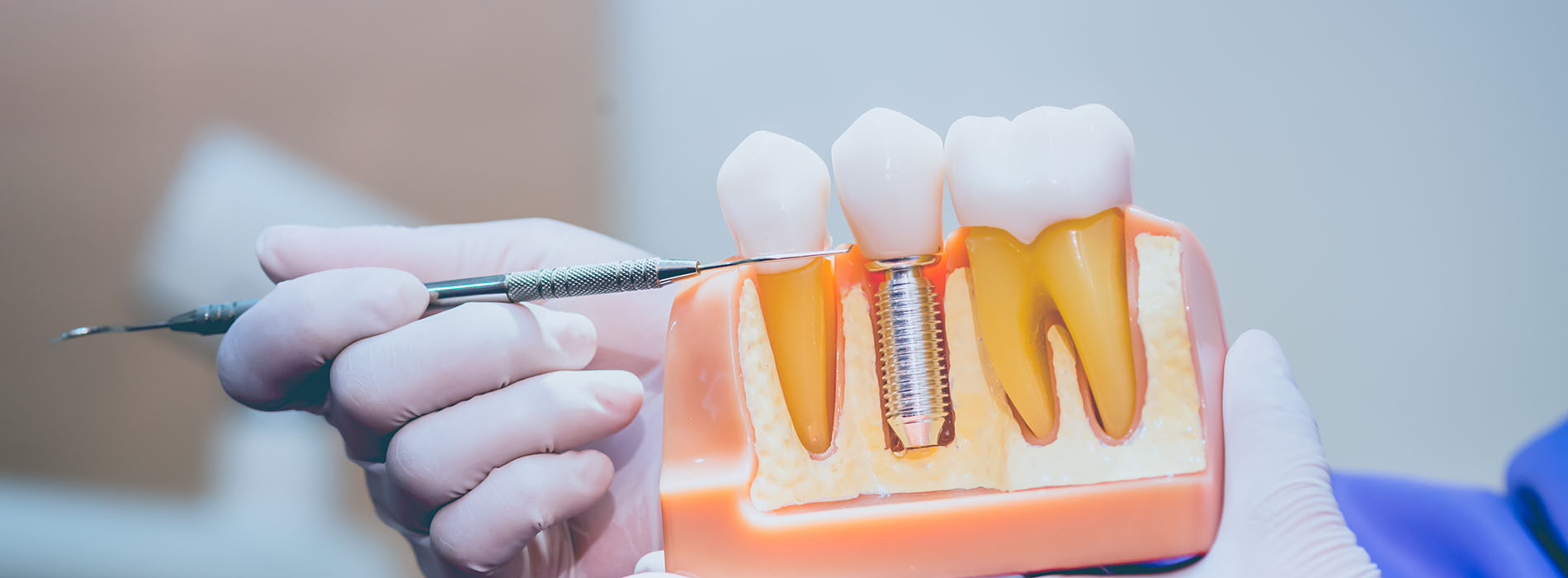 Smiles for Life | Preventative Program, Oral Cancer Screening and Root Canals