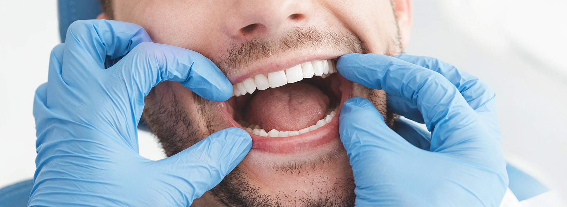 Smiles for Life | Root Canals, Extractions and Teeth Whitening
