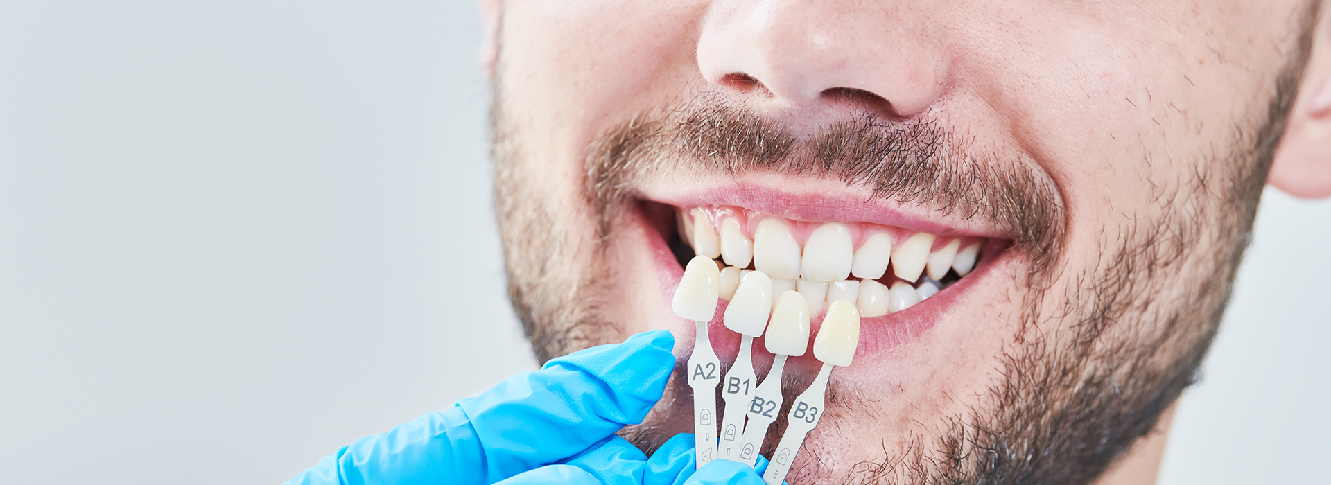 Smiles for Life | Dentures, Dental Fillings and Root Canals